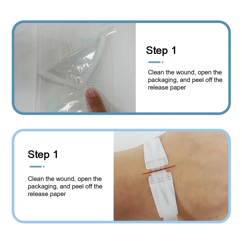 Zipper Tie Wound Closure Patch Zipper Band-Aid Wound Fast Suture Outdoor Portable Hemostatic Patch First Aid Tool