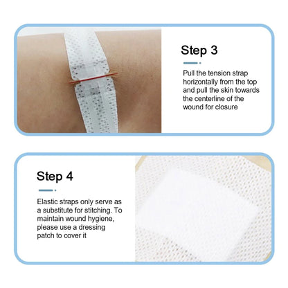 Zipper Tie Wound Closure Patch Zipper Band-Aid Wound Fast Suture Outdoor Portable Hemostatic Patch First Aid Tool